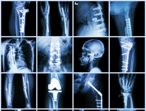 röntgenképek